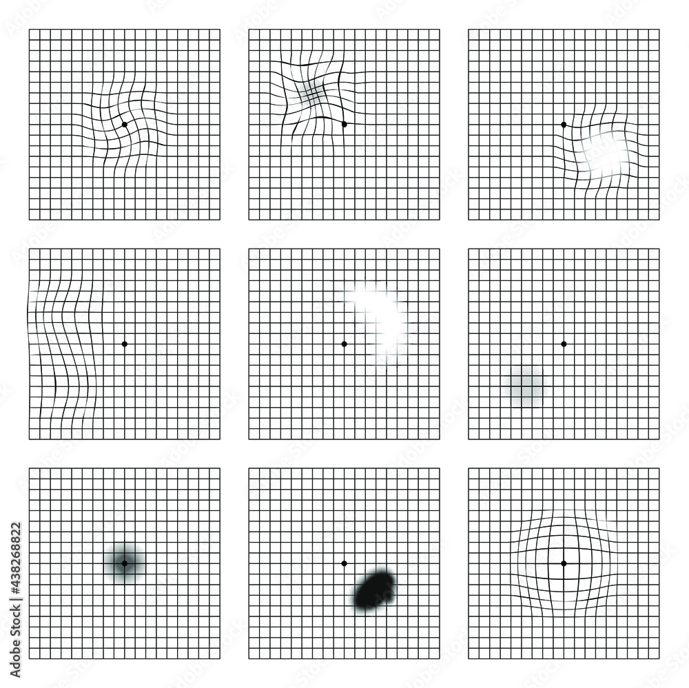 Amsler Grid Scotoma Eye Test Oculist Vector Printable Chart Retina Examination Grid With Dot In Centre Vision Control Stock Vector Adobe Stock Amsler Grid Scotoma Eye Test Oculist Vector Printable Chart Retina Examination Grid With Dot In Centre Vision Control Stock Vector Adobe Stock