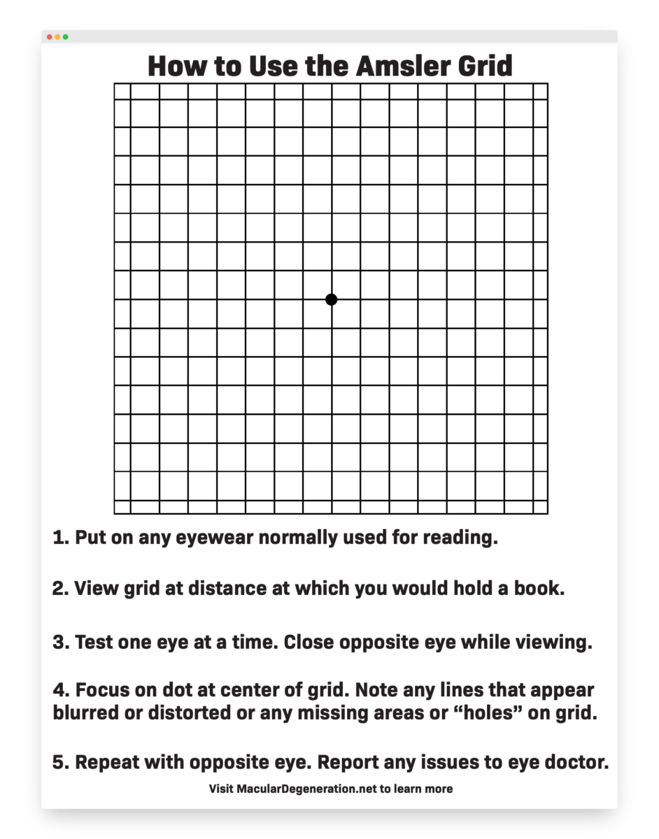 Amsler Grid Vision Tests Visual Acuity Tests New England Low Vision Amsler Grid Vision Tests Visual Acuity Tests New England Low Vision