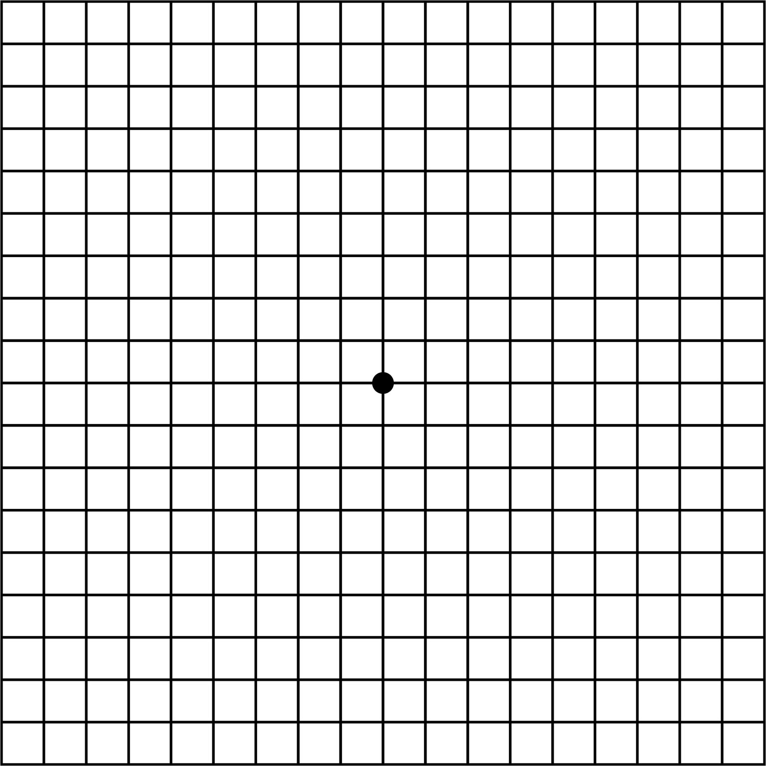 Amsler Grid Amsler Grid